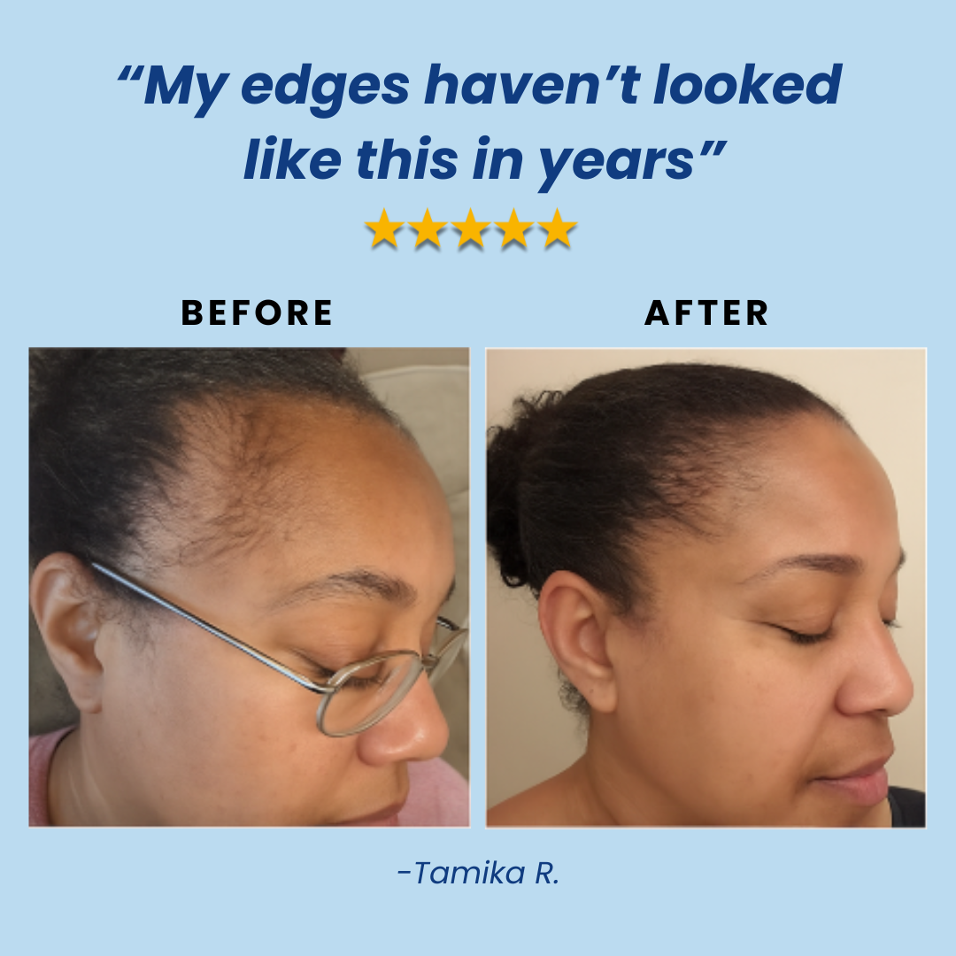 Advanced Hair Growth Roll-On Serum