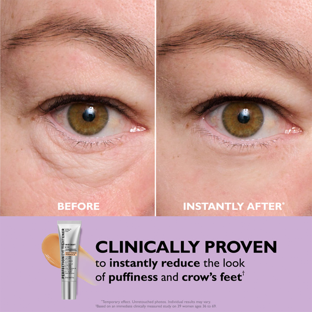 Perfection Eye Tightener