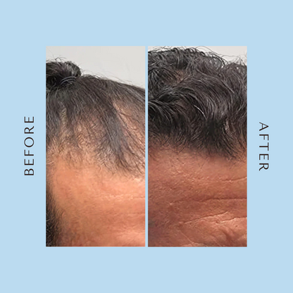 Advanced Hair Growth Roll-On Serum