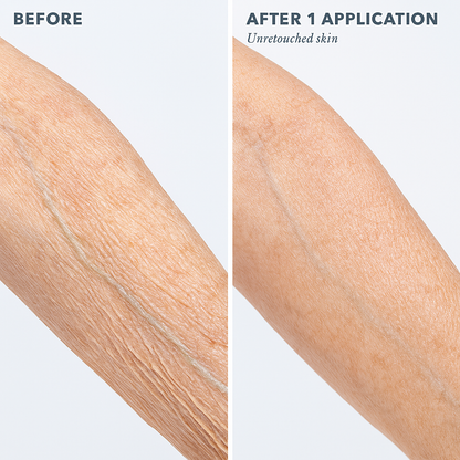 Hyaluronic Body Serum
